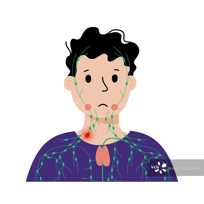 淋巴瘤，概念图图片素材