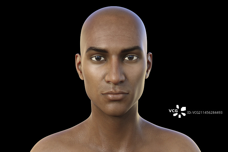 没有头发的男人，插画图片素材