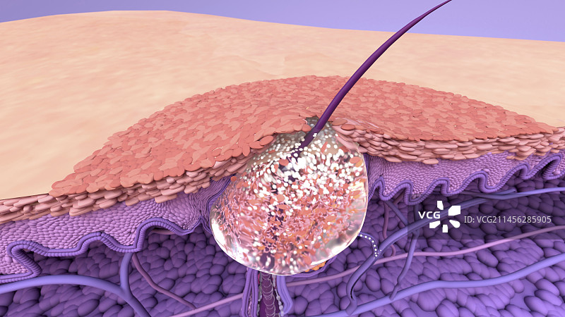 粉刺插画图片素材