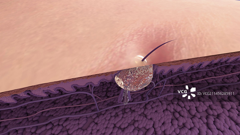 粉刺插画图片素材