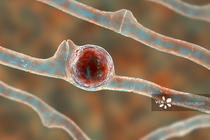 蛙粪掷孢霉菌插图图片素材