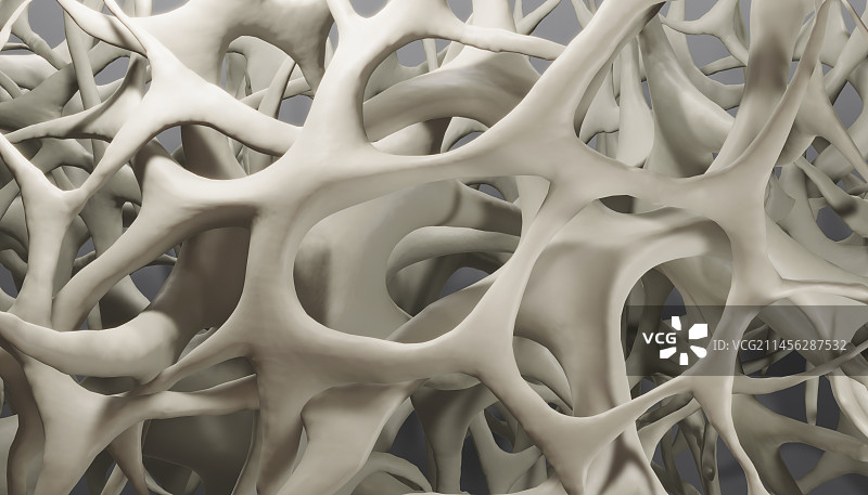 骨质疏松症，图示图片素材