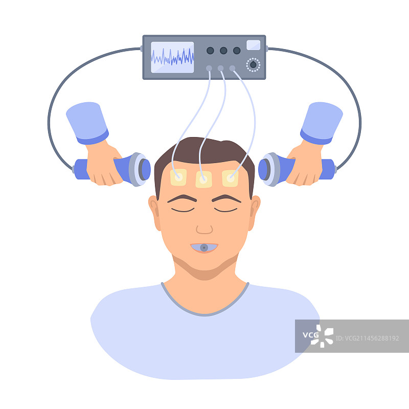 电休克疗法，插图图片素材