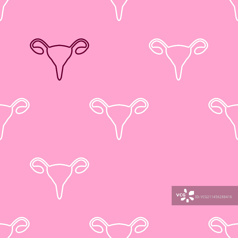 多囊卵巢综合征概念图图片素材