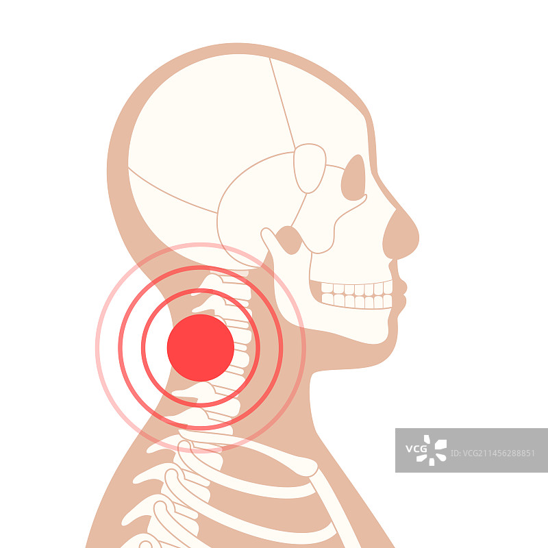 颈部疼痛概念图图片素材