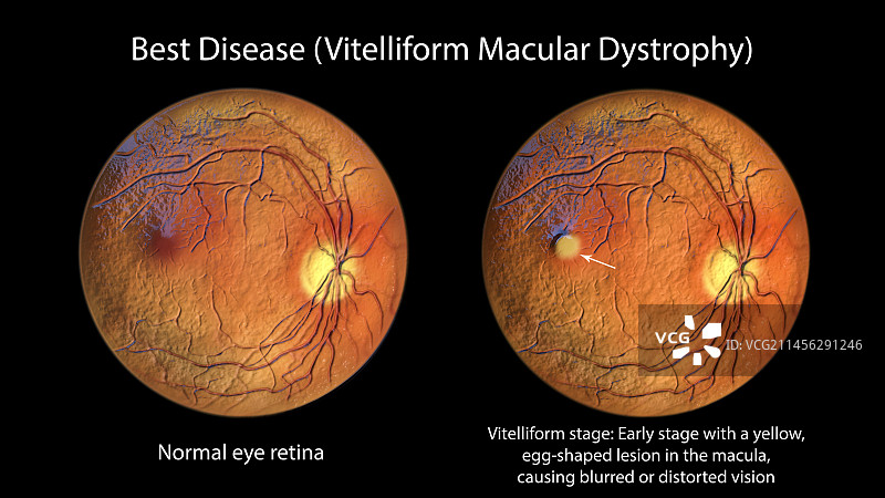 疾病插画精选图片素材