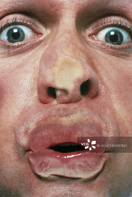 被挤压的人脸图片素材