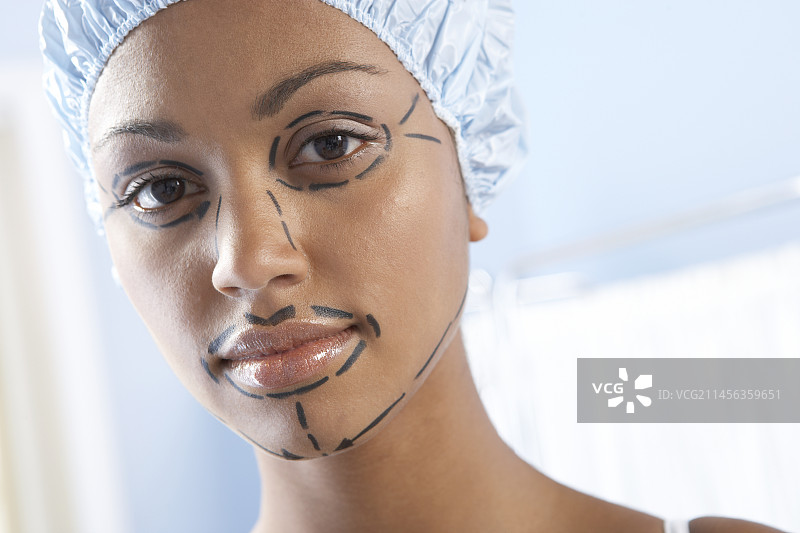 面部拉皮手术标记图片素材