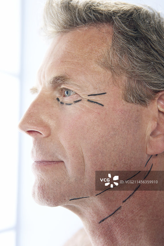 美容外科图片素材