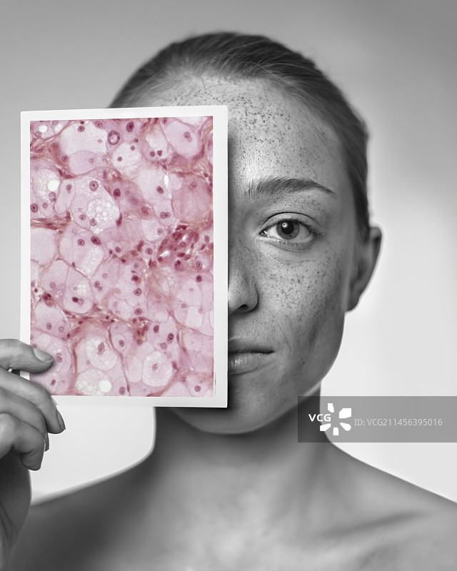 阳光损伤图片素材