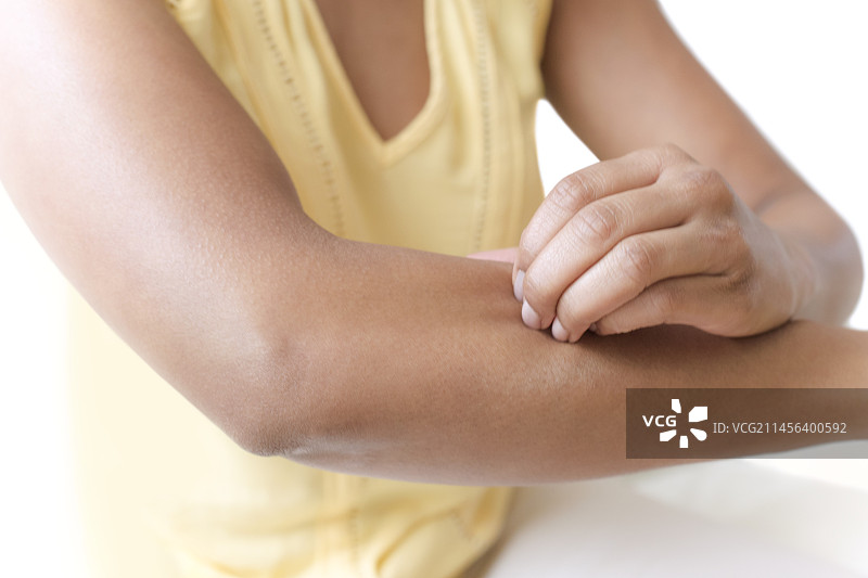 女人挠胳膊图片素材