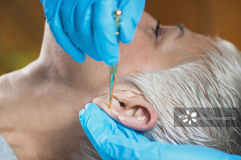 耳穴疗法图片素材