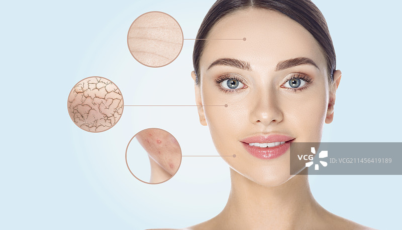 皮肤问题图片素材