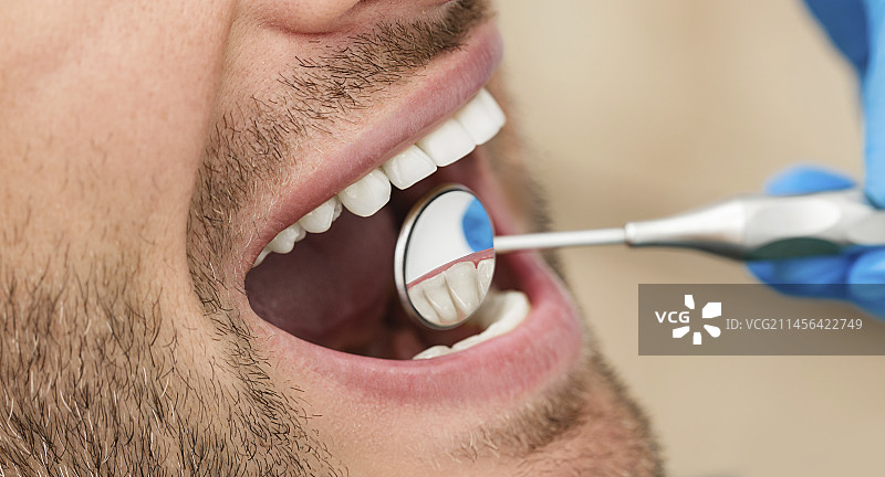 牙科检查图片素材