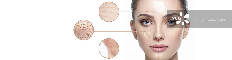 皮肤问题图片素材