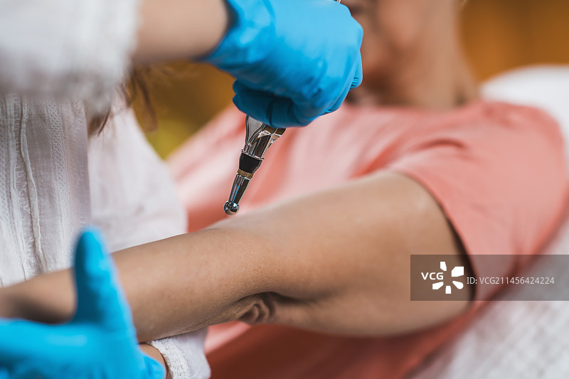 正在用经络理疗笔接受肘部治疗的女人图片素材