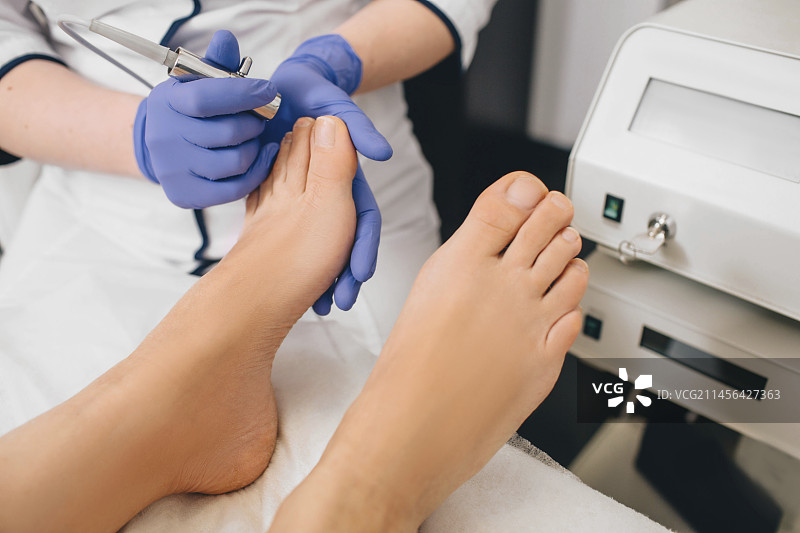 甲癣治疗图片素材