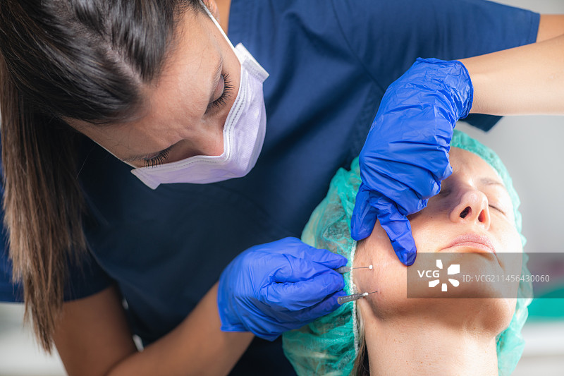 面部埋线提升术图片素材