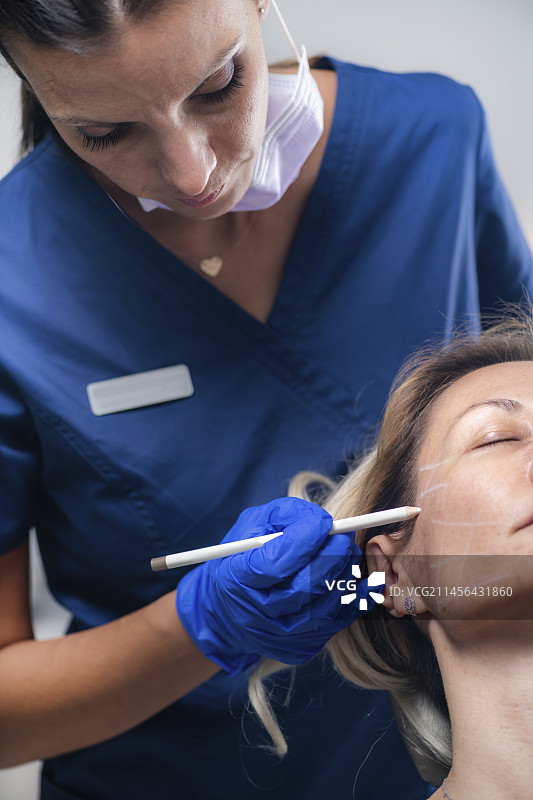 面部埋线提升术图片素材