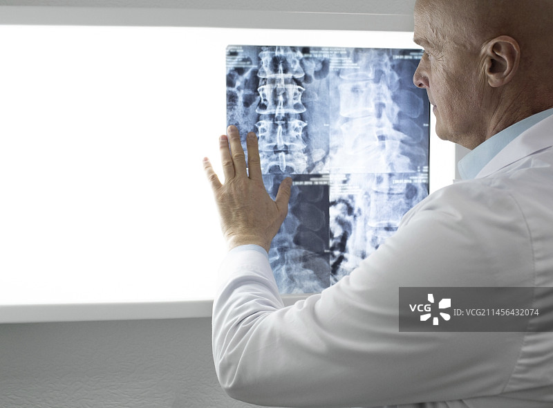 医生检查脊柱X光片图片素材