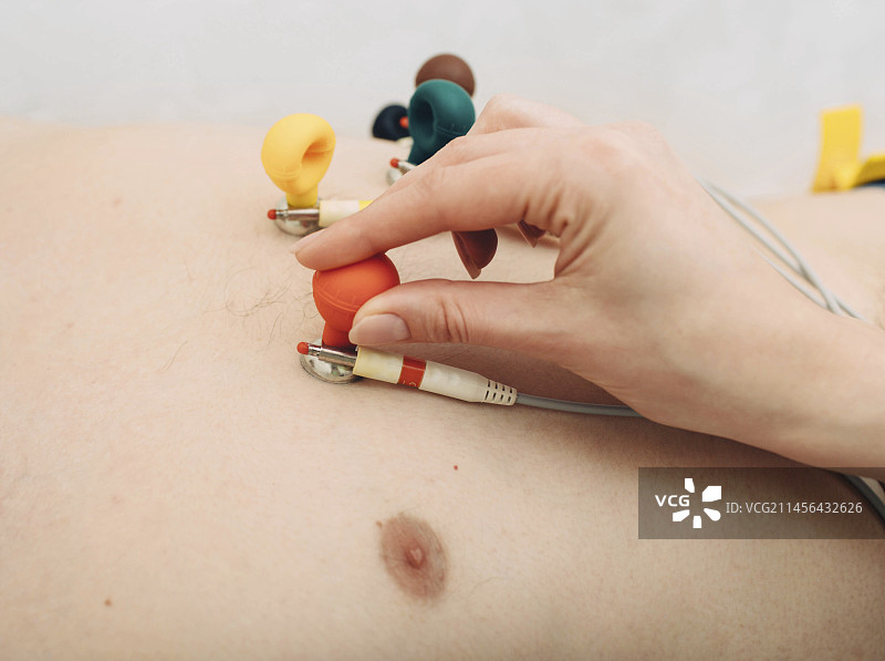 心电图电极图片素材