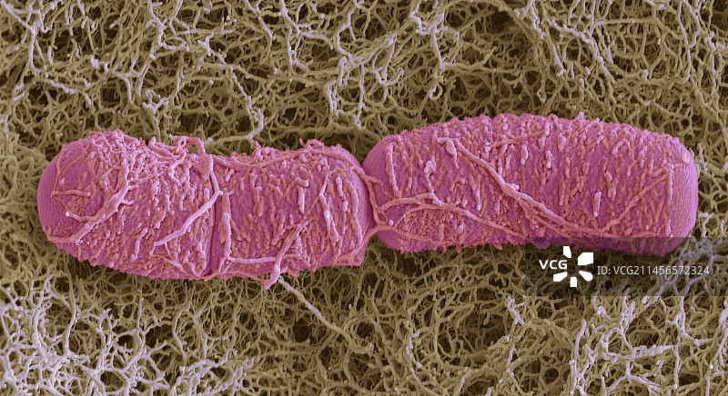 耳部细菌扫描电镜图图片素材