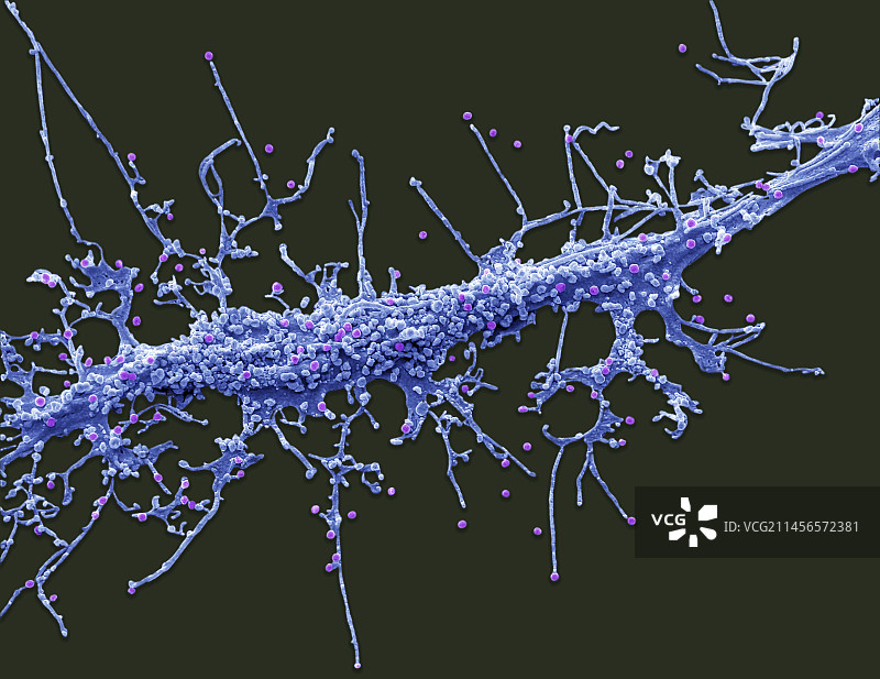艾滋病毒，扫描电子显微镜图像图片素材