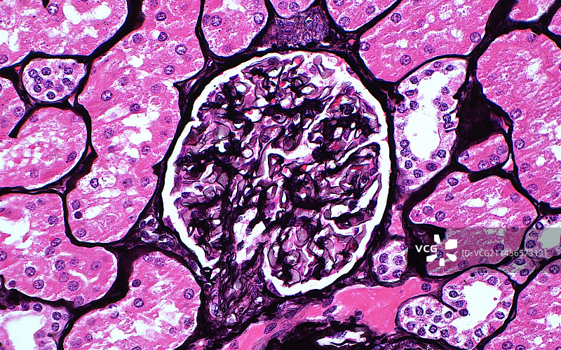 肾小球显微照片图片素材