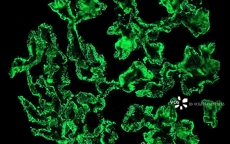 膜性肾小球疾病，光学显微照片图片素材