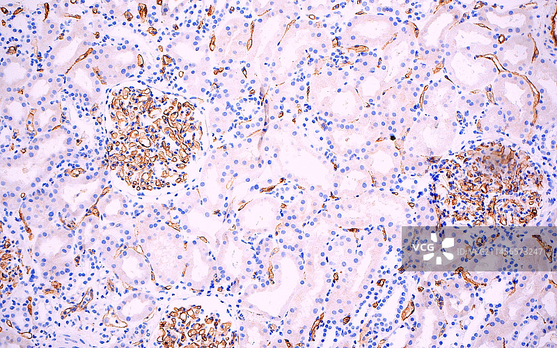 C4d肾活检，光学显微照片图片素材