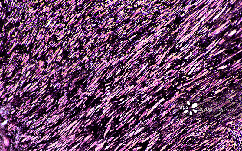 肾动脉壁，光学显微照片图片素材