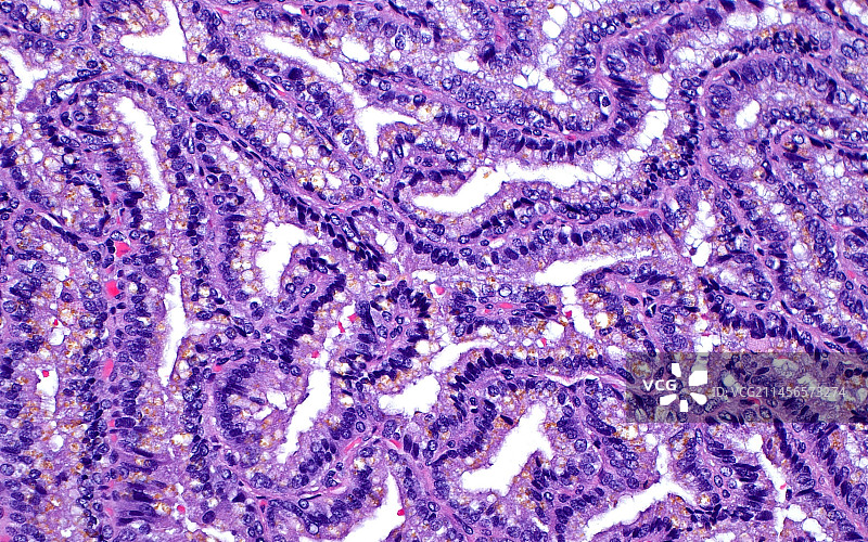 精囊细胞显微照片图片素材
