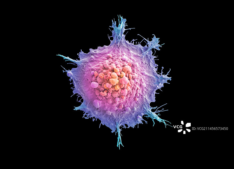 肺癌细胞扫描电镜图图片素材