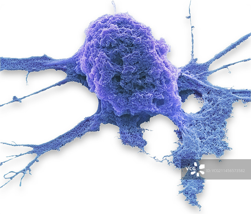 化疗，扫描电镜图片素材