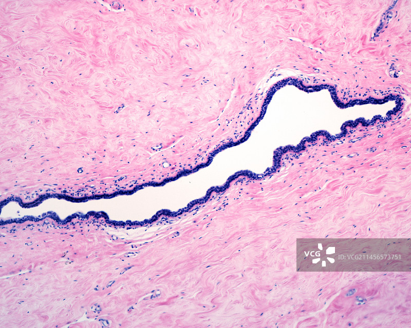 乳腺导管显微照片图片素材
