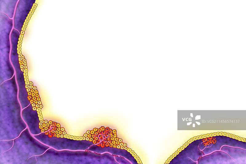 癌症插画图片素材