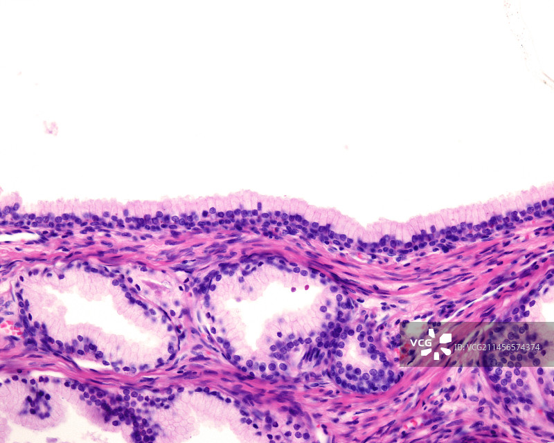 前列腺上皮细胞显微照片图片素材