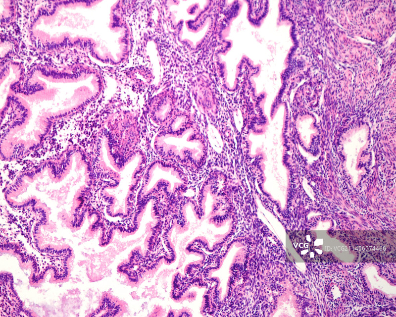 分泌期的人类子宫内膜显微照片图片素材