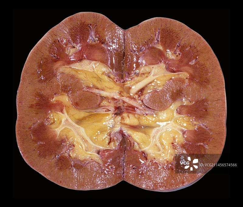 肾脏图片素材