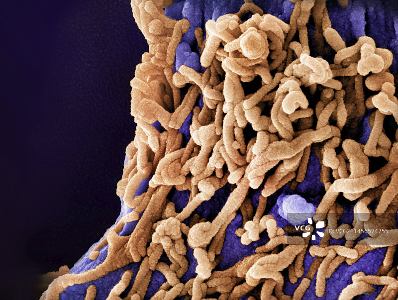 马尔堡病毒颗粒（扫描电镜图）图片素材