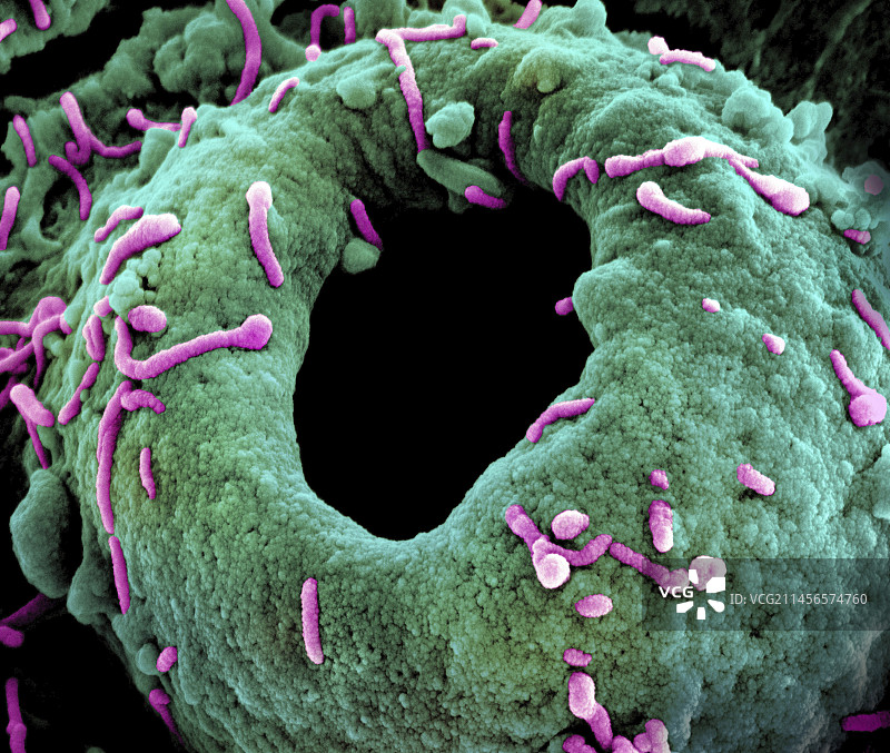 马尔堡病毒颗粒（扫描电镜图）图片素材