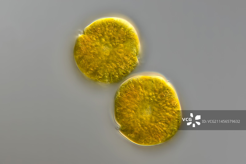 沃洛申斯基亚藻类显微照片图片素材