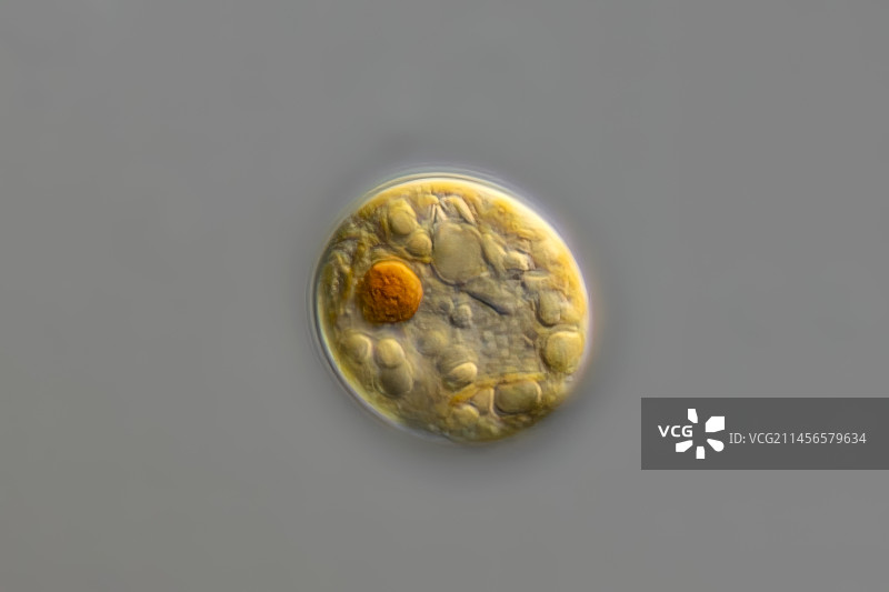 颗粒状莱昂内拉藻显微照片图片素材