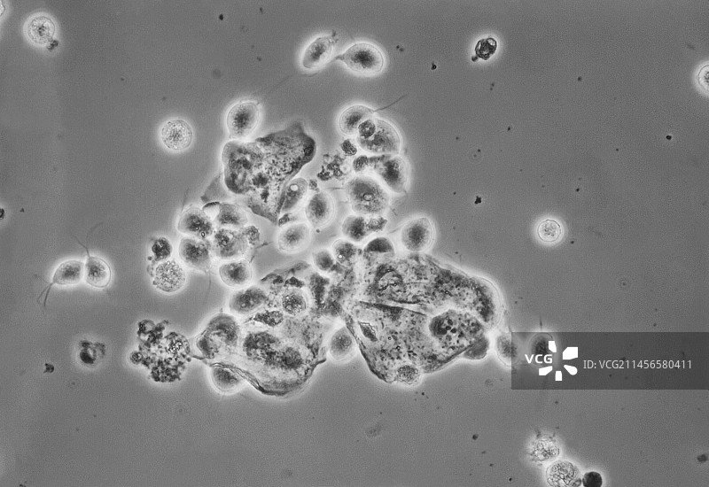 阴道毛滴虫显微照片图片素材