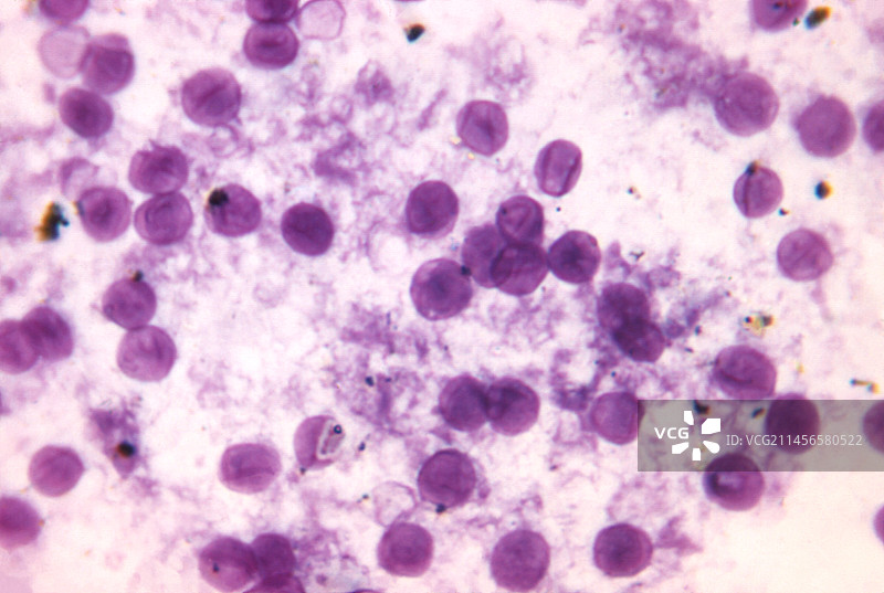 肺组织中的卡氏肺孢子虫真菌图片素材