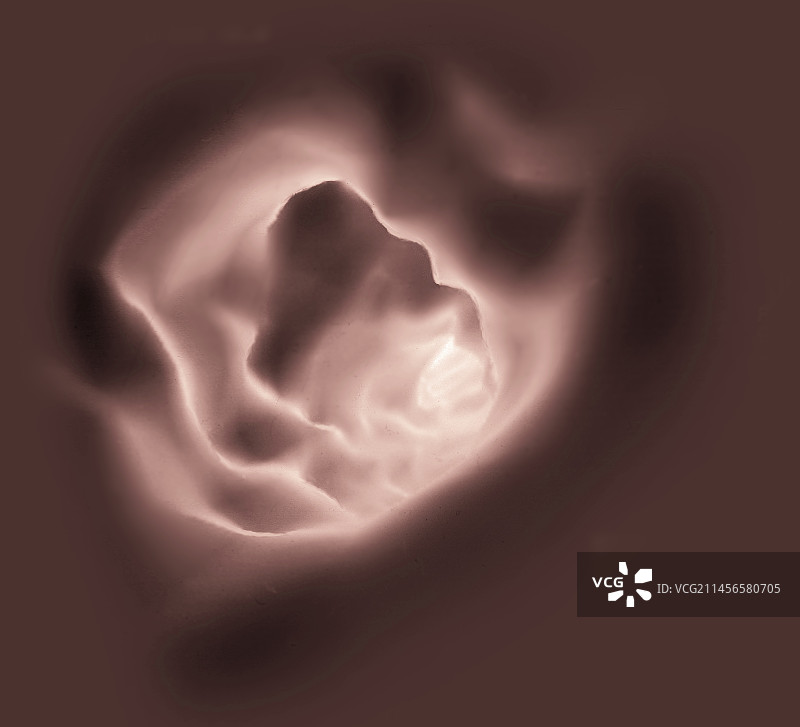 颈动脉3D CT扫描图片素材