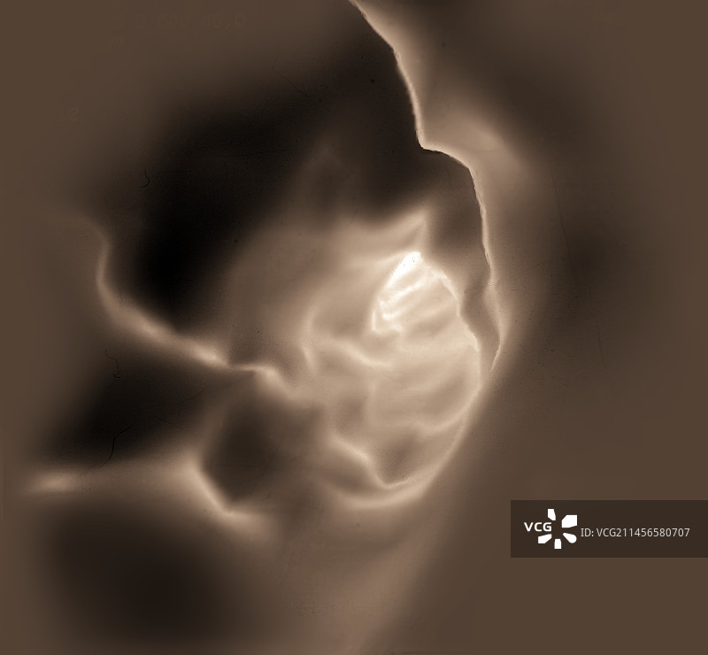 颈动脉3D CT扫描图片素材