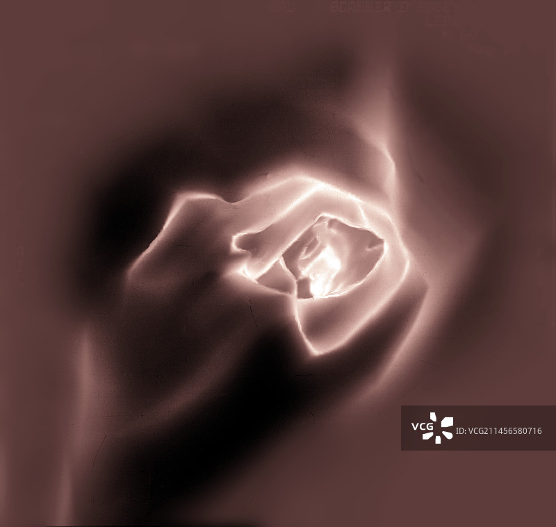 颈动脉3D CT扫描图片素材