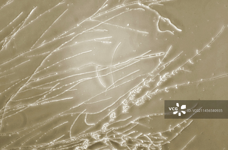 白色念珠菌真菌显微照片图片素材