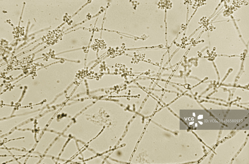 白色念珠菌真菌显微照片图片素材